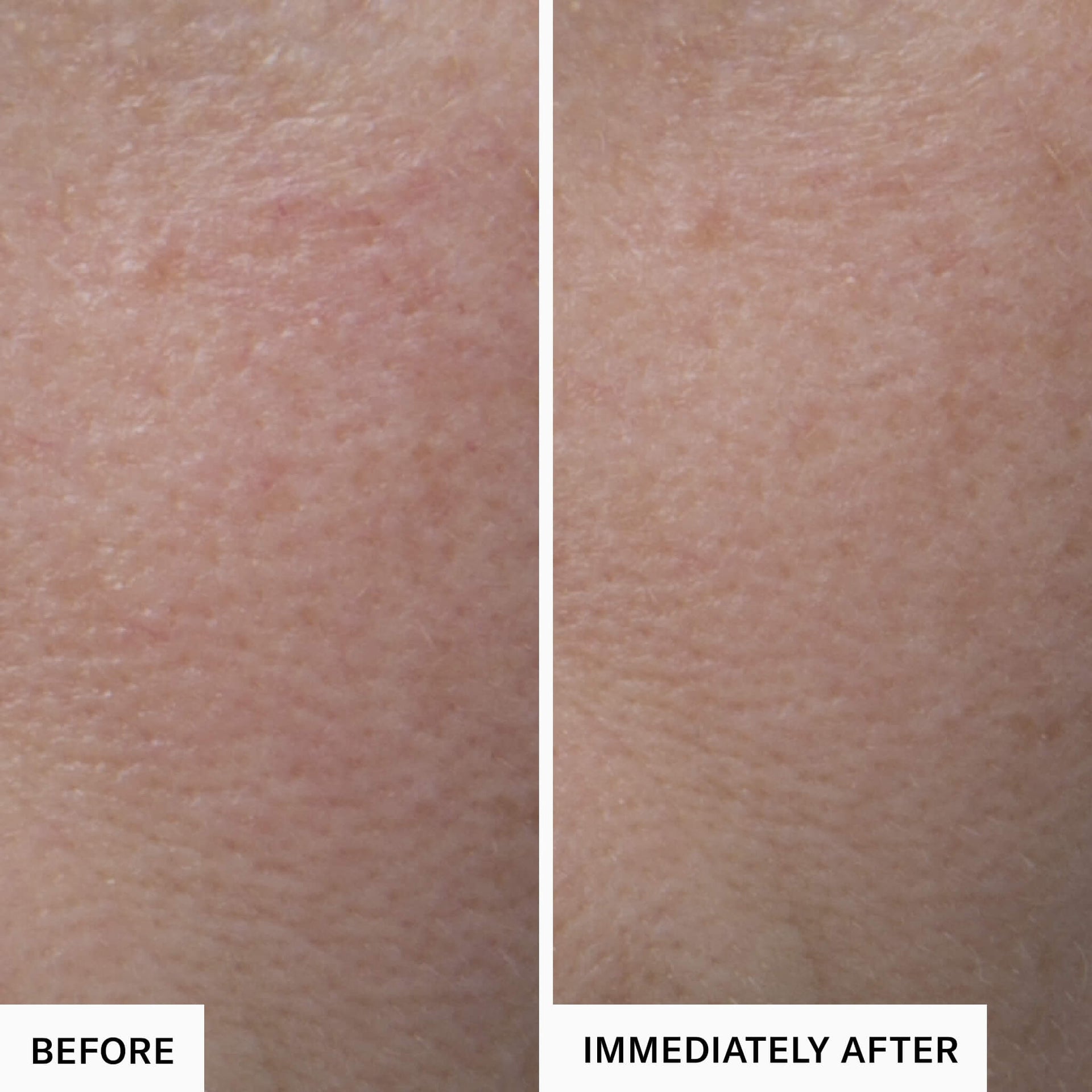 Before and Immediately After.