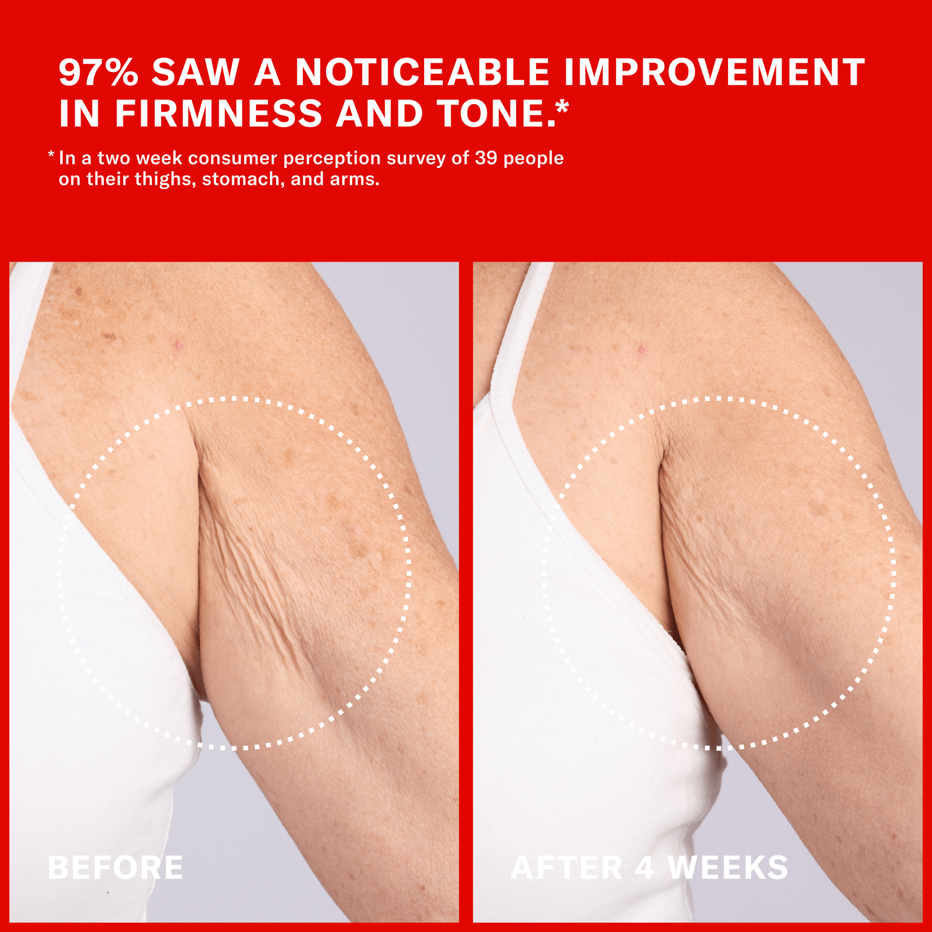 Claims and Before and After image. 97% saw a noticeable improvement in firmness and tone in a two week consumer perception survey of 39 people on their thighs, stomach and arms
