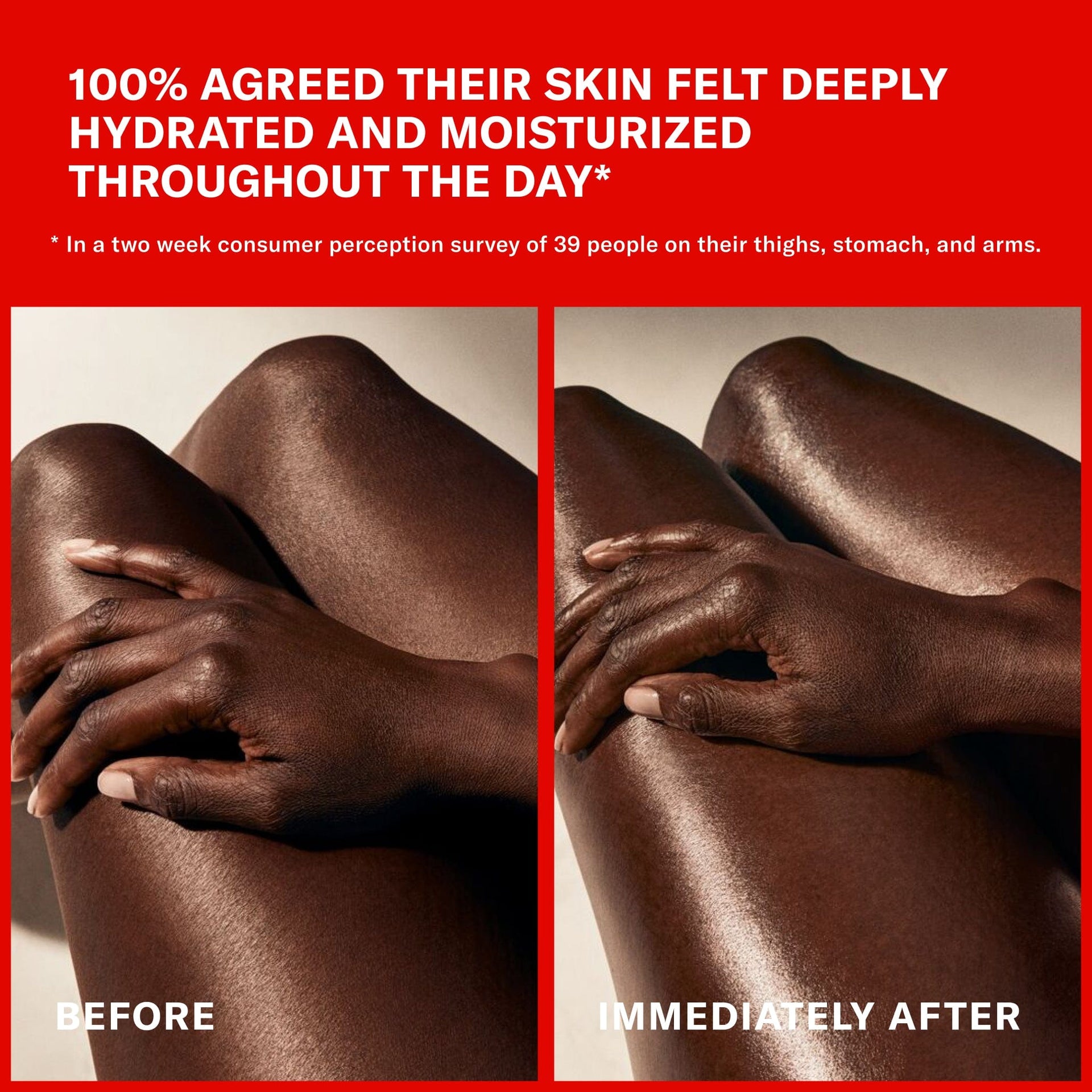 Claims and Before and After image. 100% agreed their skin felt deeply hydrated and moisturized throughout the day in a week consumer perception survey of 39 people, on their thighs, stomach and arms.