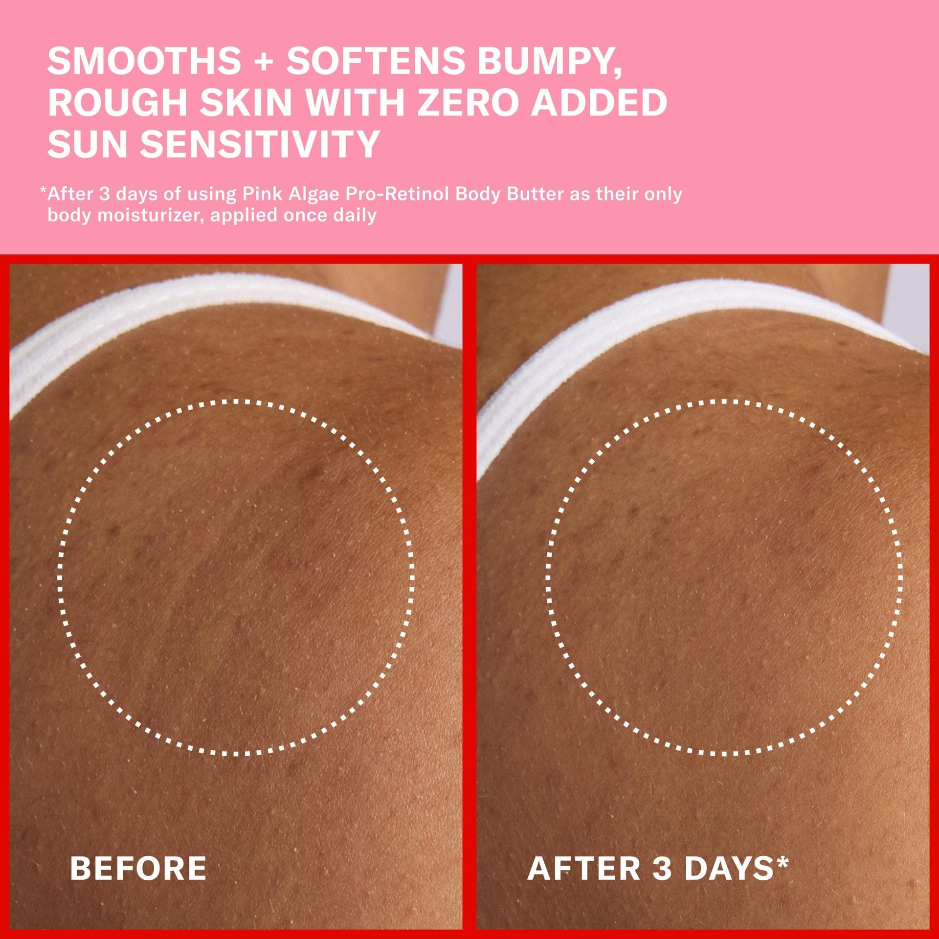 Claims and Before and After. Smooths + Softens bumpy, rough sin with zero sun sun sensitivity