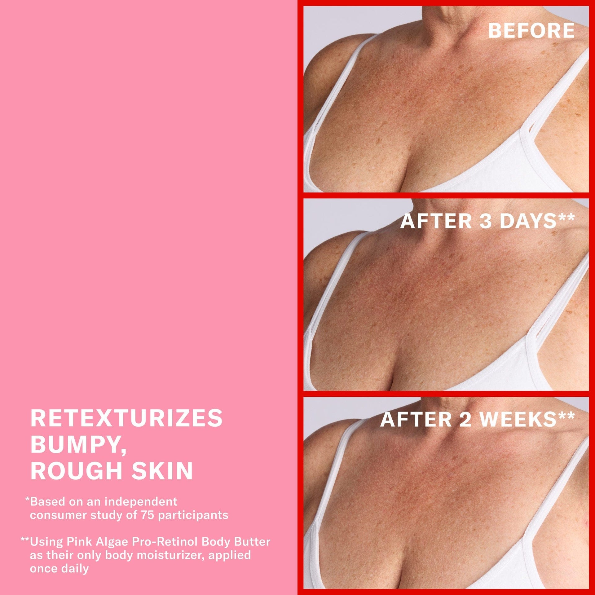 Retexturizes bumpy, rough skin. Claims based on an independent consumer study of 75 participants.