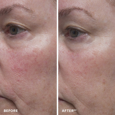 Triple Hydroxy Resurfacing Liquid
