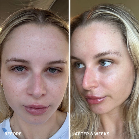 Before and After