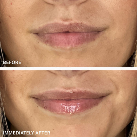 Pro-Retinol Vita Volumizer Lip Treatment