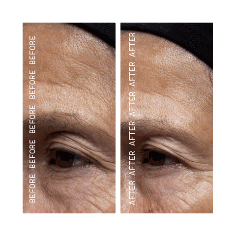 Argan Beta-Retinoid Pink Algae Serum Before and After Result Images in Animation.