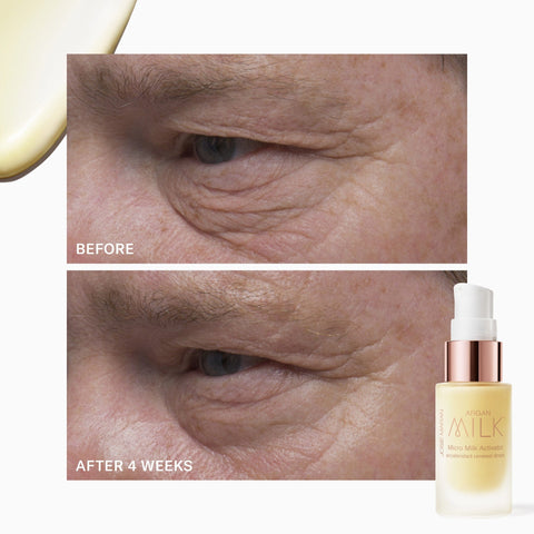 Micro Milk Activator Accelerated Renewal Drops